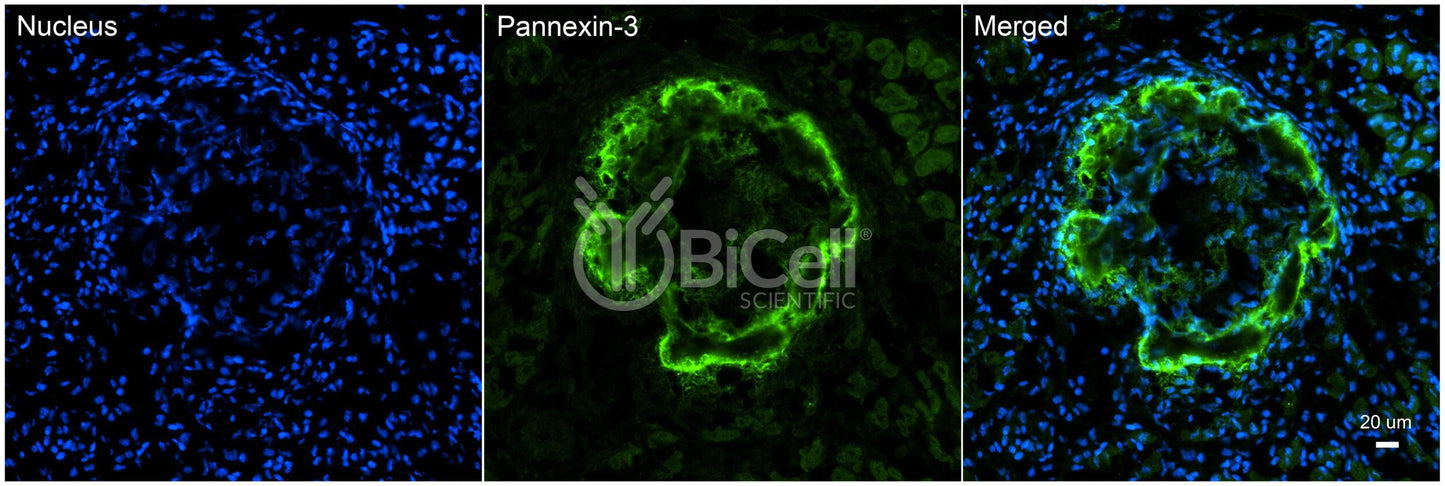 Pannexin-3 (PANX3) Antibody
