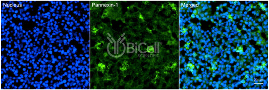 Pannexin-1 (PANX1) Antibody - Western Blot Validated