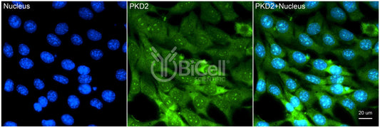 Polycystin-2 (PKD2) Monoclonal Antibody (G6 Clone) - Western Blot Validated