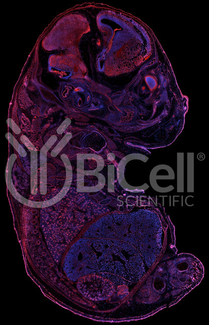 P-Cadherin (Cadherin-3 or CDH3) Antibody - FFPE Validated