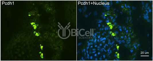 Protocadherin-1 (PCDH1 or PCDH42) Antibody - FFPE Validated