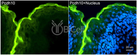 Protocadherin-10 (PCDH10 or OL-PCDH) Antibody - Western Blot Validated