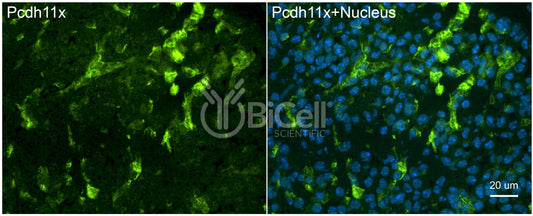 Protocadherin-11 X-linked (PCDH11X or PCDH11) Antibody - FFPE Validated