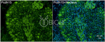Protocadherin-15 (PCDH15 or CDHR15 or USH1F or DFNB23) Antibody - FFPE Validated