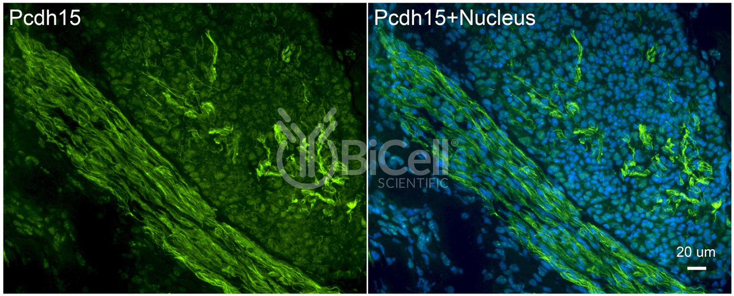 Protocadherin-15 (PCDH15 or CDHR15 or USH1F or DFNB23) Antibody