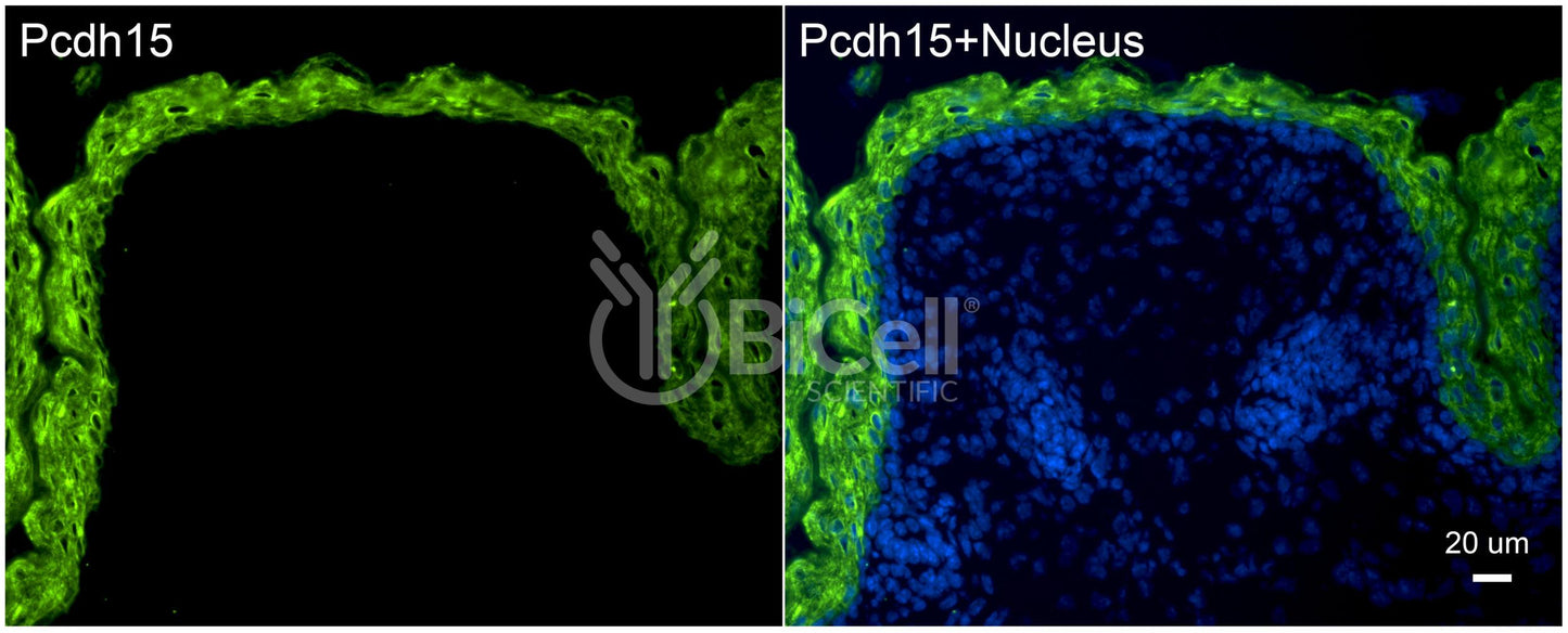 Protocadherin-15 (PCDH15 or CDHR15 or USH1F or DFNB23) Antibody