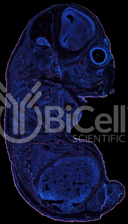 Protocadherin-15 (PCDH15 or CDHR15 or USH1F or DFNB23) Antibody - FFPE Validated