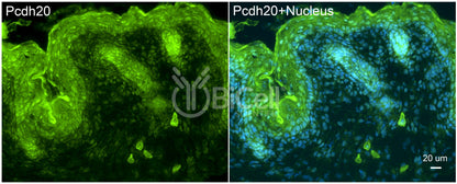 Protocadherin-20 (PCDH20 or PCDH13) Antibody - Western Blot Validated
