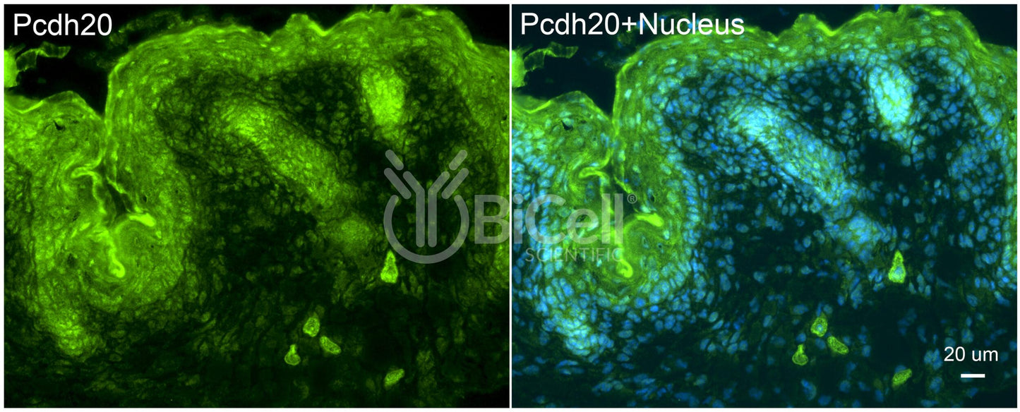 Protocadherin-20 (PCDH20 or PCDH13) Antibody - FFPE Validated