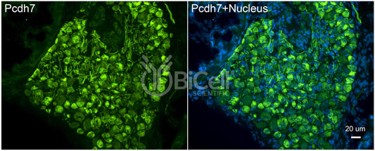 Protocadherin-7 (PCDH7 or BHPCDH) Antibody - FFPE Validated