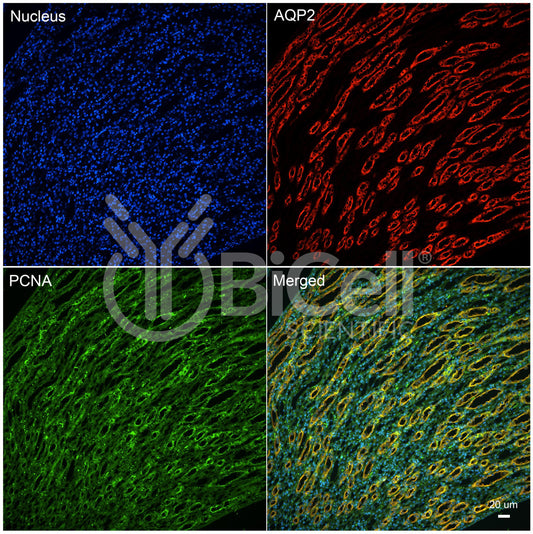 PCNA Antibody - FFPE Validated