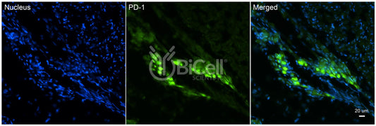 PD-1 (PDCD1 or CD279) Antibody - Western Blot Validated