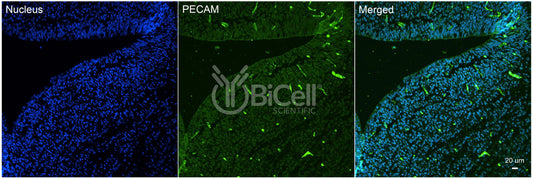 PECAM1 (CD31) Antibody - FFPE Validated
