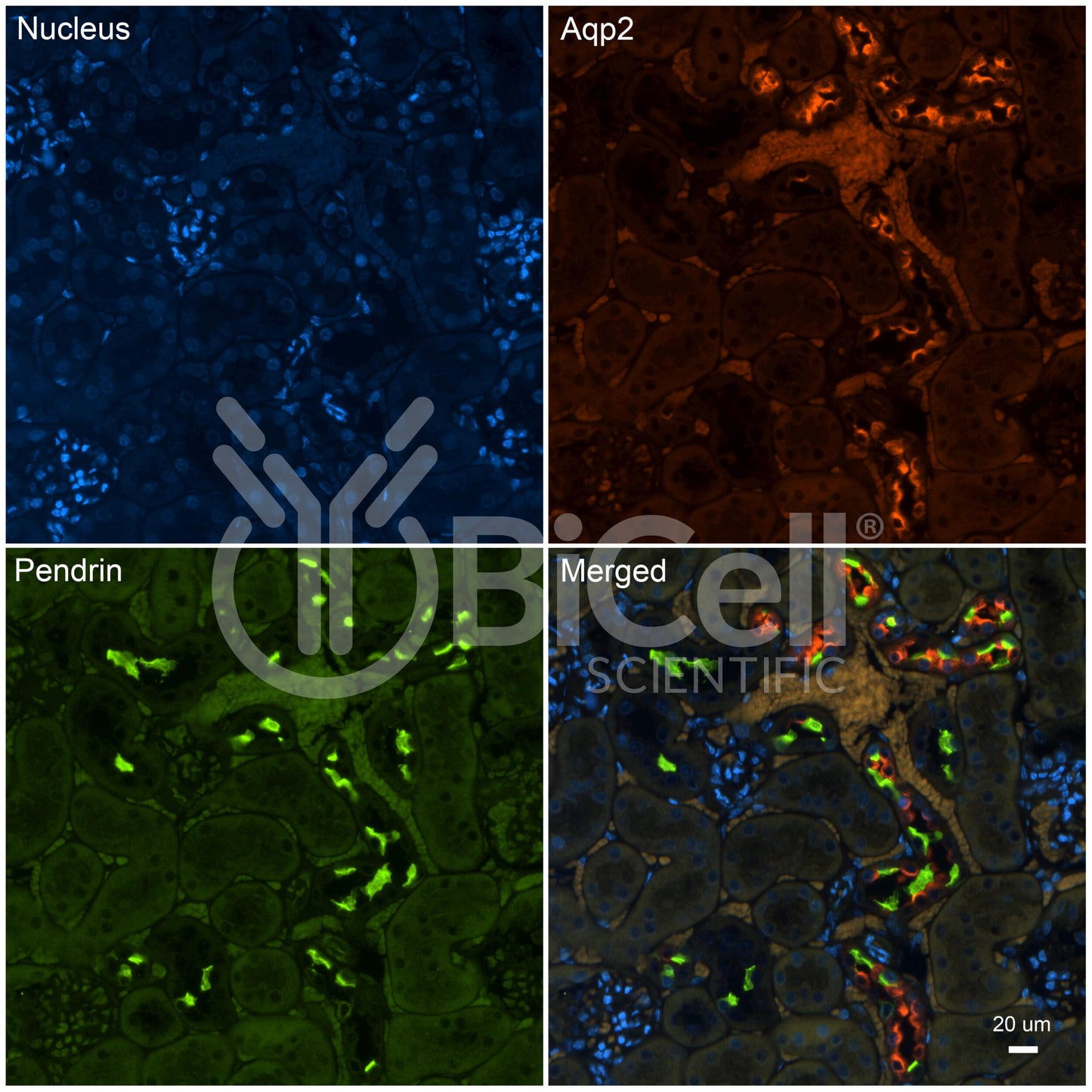 Pendrin (Slc26a4) Antibody - FFPE Validated