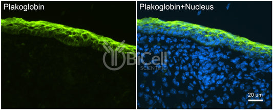 Plakoglobin (gamma-catenin or JUP) Antibody - Western Blot Validated