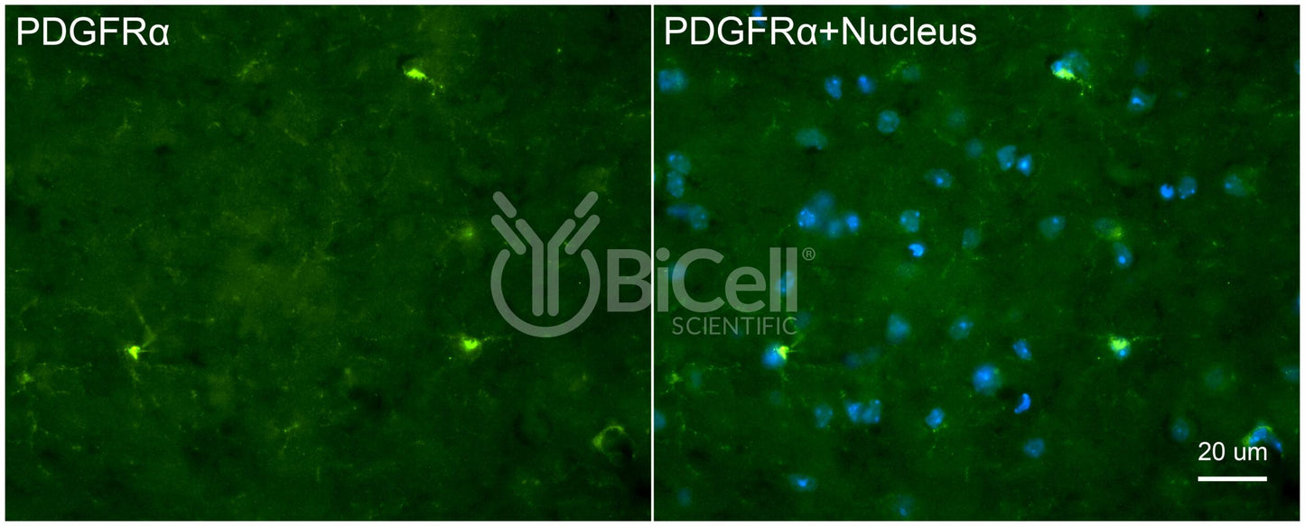 PDGFRA (CD140a) Antibody - FFPE Validated