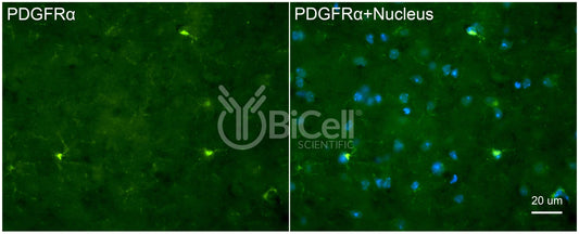 PDGFRA (CD140a) Antibody - FFPE Validated