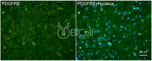 PDGFRB (CD140b) Antibody - Western Blot Validated