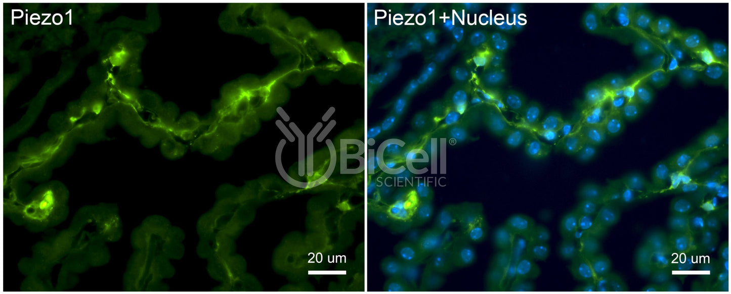 Piezo1 (Internal) Antibody - FFPE Validated