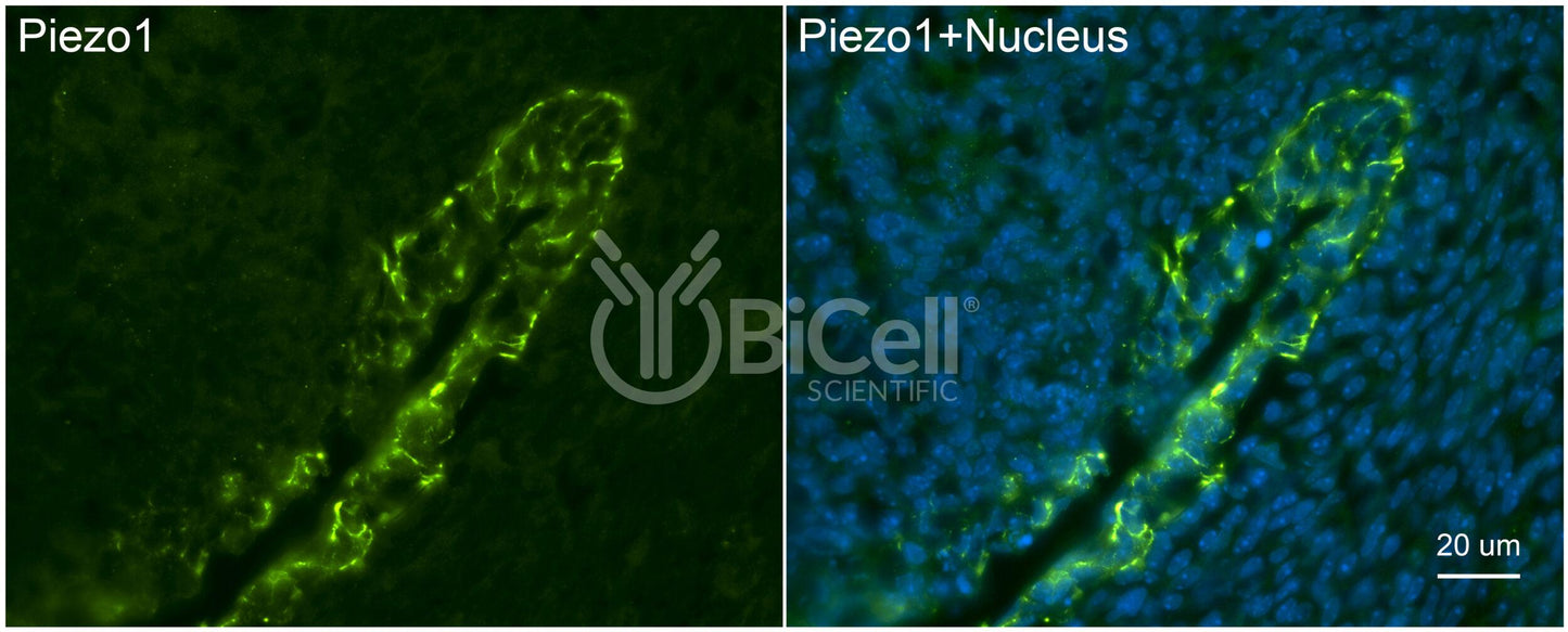 Piezo1 (C-Terminus) Antibody - FFPE Validated