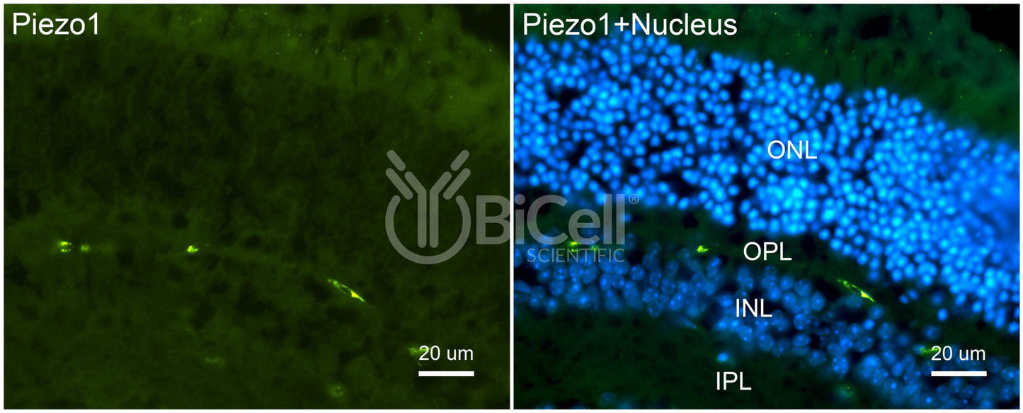 Piezo1 (Internal) Antibody - FFPE Validated