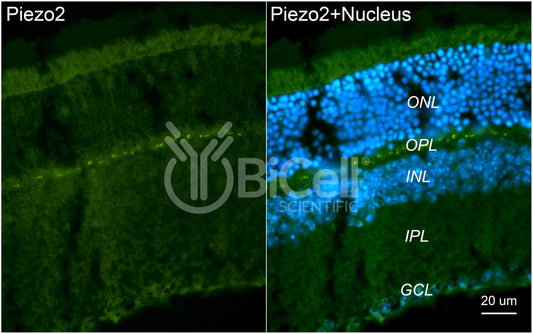 Piezo2 Antibody