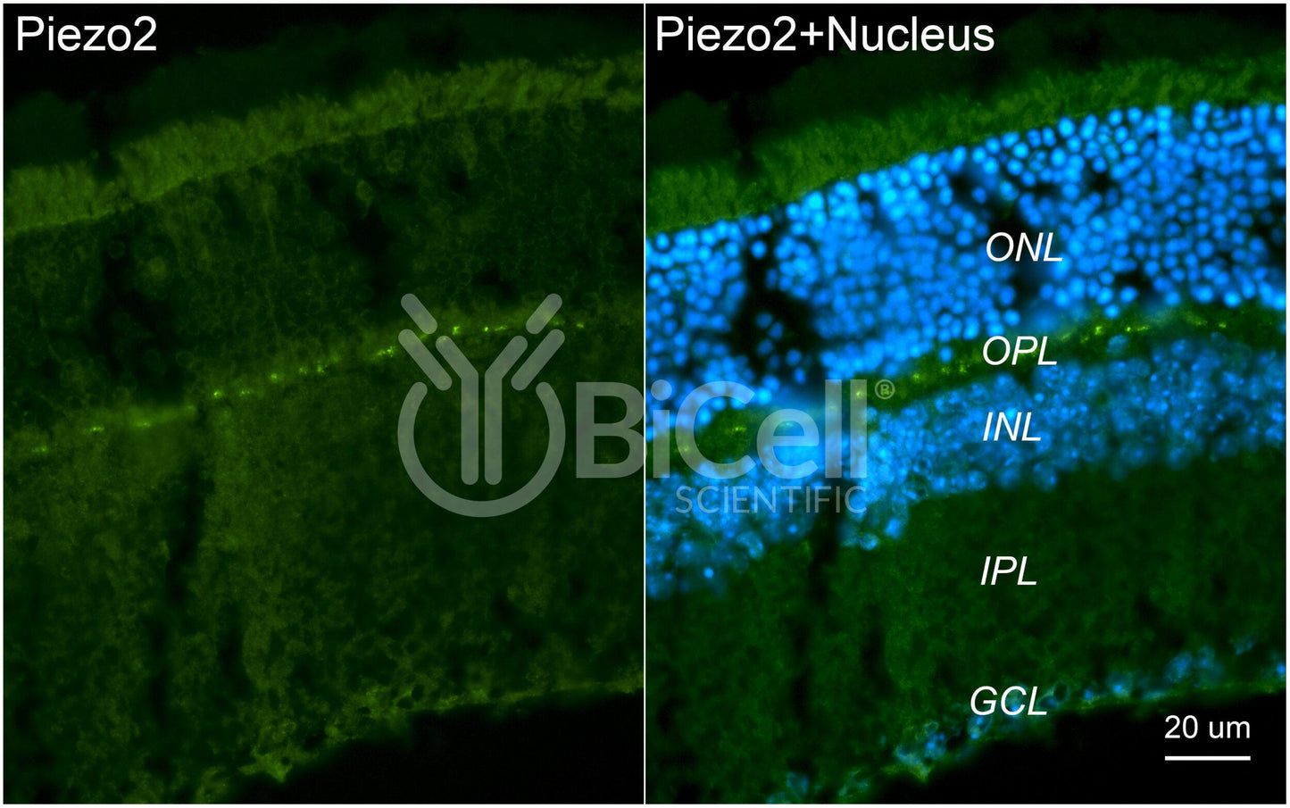 Piezo2 Antibody - FFPE Validated