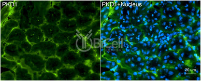 Polycystin-1 (PKD1) Monoclonal Antibody (B2 Clone) - Western Blot Validated