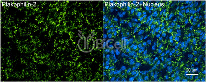 Plakophilin-2 (PKP2) Antibody - Western Blot Validated