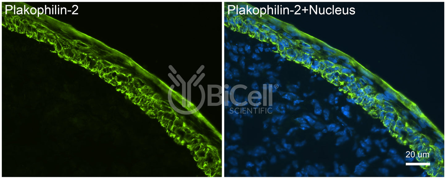 Plakophilin-2 (PKP2) Antibody - Western Blot Validated