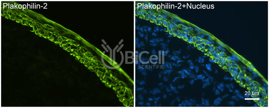 Plakophilin-2 (PKP2) Antibody - FFPE Validated