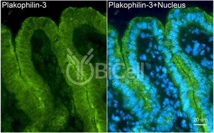 Plakophilin-3 (PKP3) Antibody - Western Blot Validated