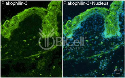 Plakophilin-3 (PKP3) Antibody - Western Blot Validated