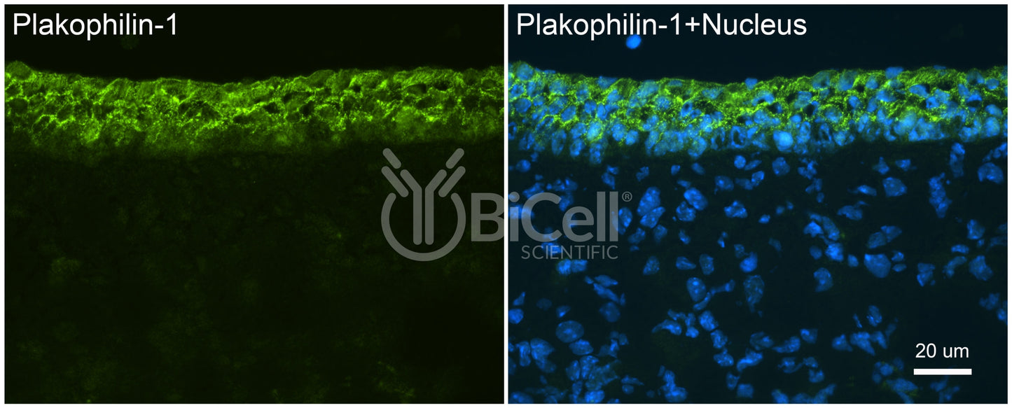 Plakophilin-1 (PKP1) Antibody - FFPE Validated