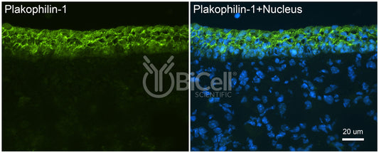 Plakophilin-1 (PKP1) Antibody