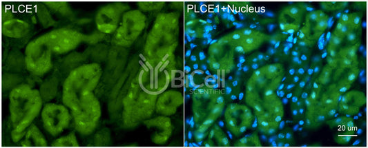 PLCE1 (PLCE) Antibody - FFPE Validated