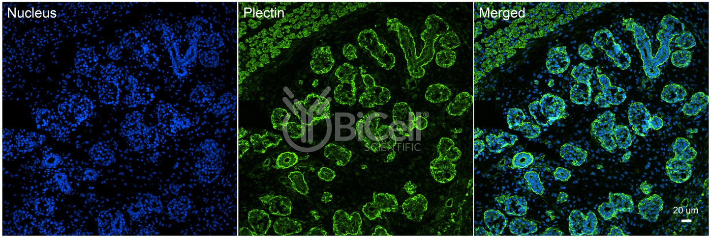 Plectin (PLEC) Antibody - Western Blot Validated