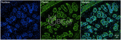 Plectin (PLEC) Antibody - Western Blot Validated