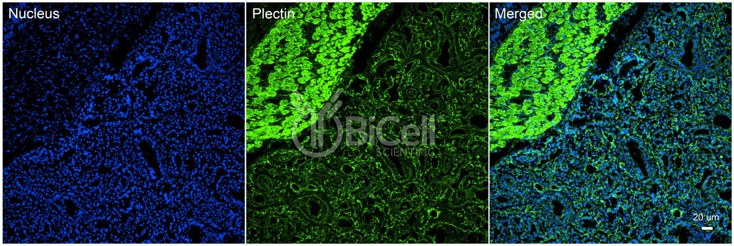 Plectin (PLEC) Antibody - Western Blot Validated