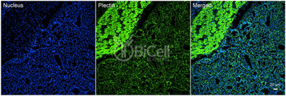 Plectin (PLEC) Antibody - Western Blot Validated