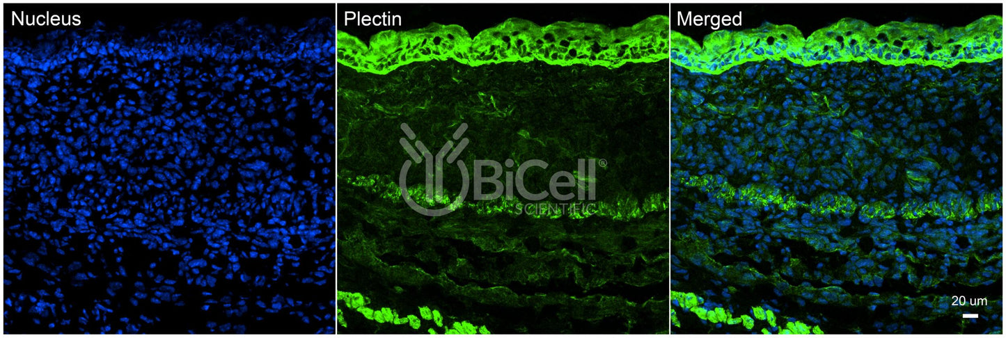 Plectin (PLEC) Antibody - Western Blot Validated