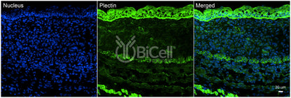 Plectin (PLEC) Antibody