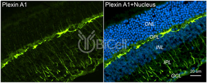 Plexin A1 (PLXNA1) Antibody - Western Blot Validated