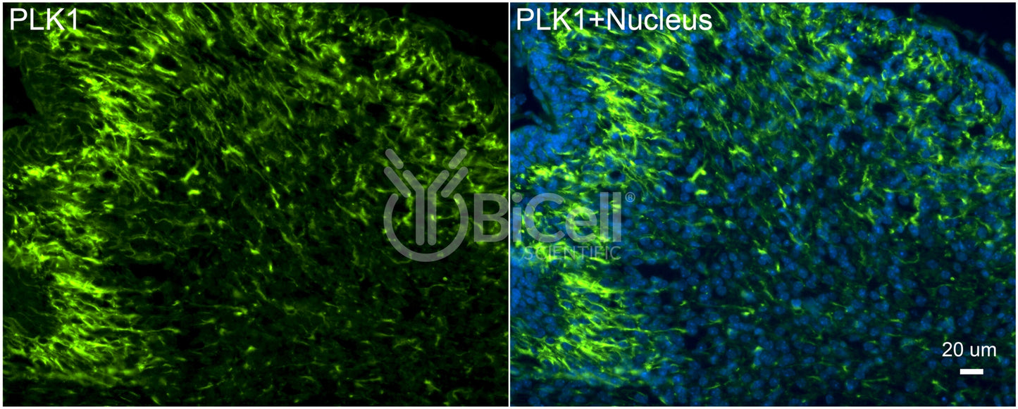 PLK1 (PLK or STPK13) Antibody - FFPE Validated