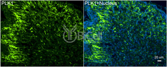 PLK1 (PLK or STPK13) Antibody - FFPE Validated