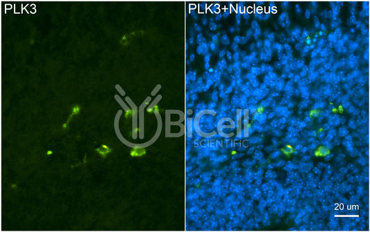 PLK3 (CNK) Antibody - FFPE Validated