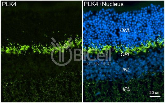 PLK4 (SAK or STK18) Antibody - Western Blot Validated