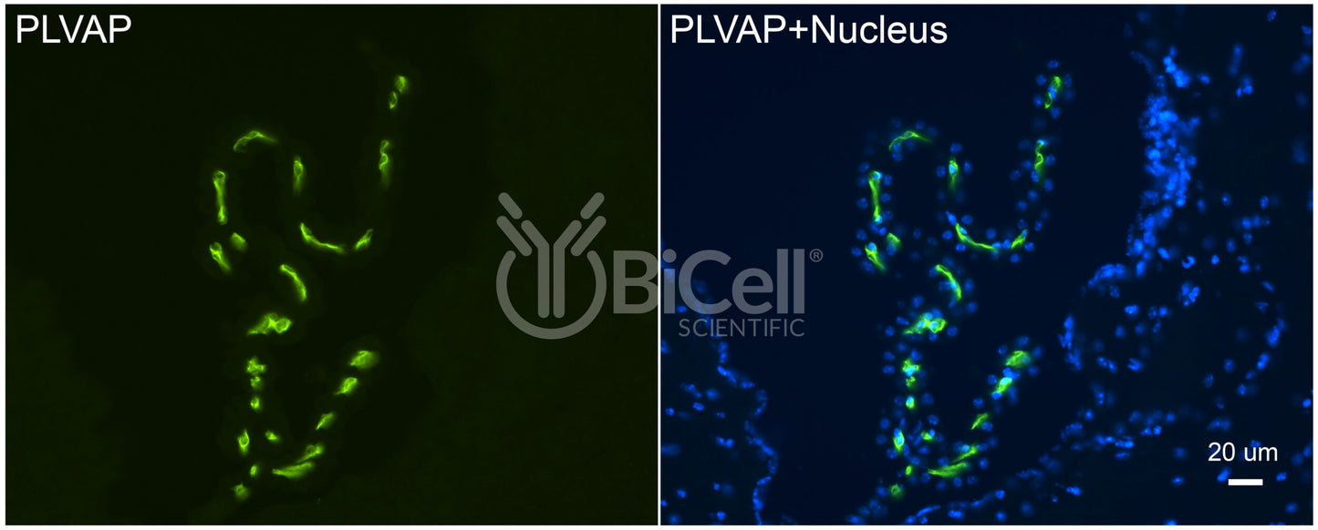 PLVAP (PV1) Antibody