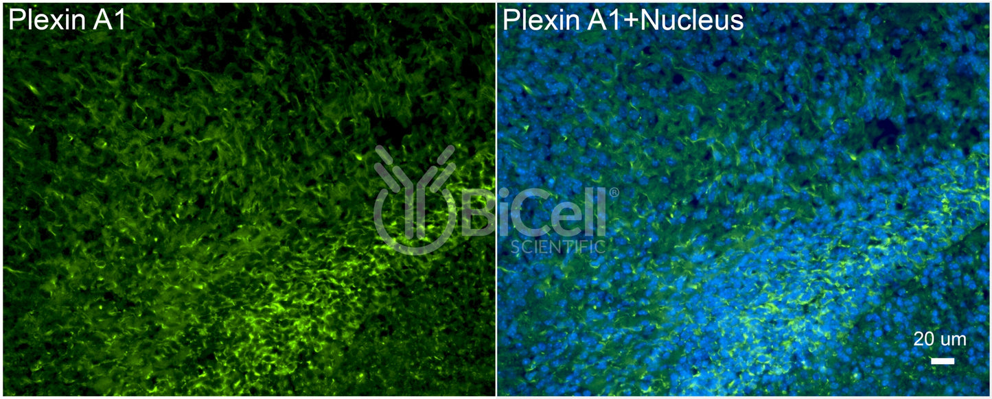 Plexin A1 (PLXNA1) Antibody - Western Blot Validated