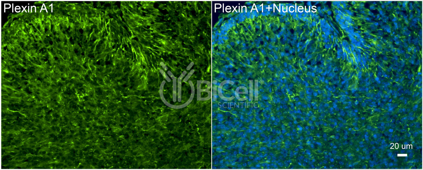 Plexin A1 (PLXNA1) Antibody